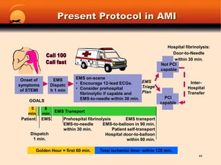 Hollywood Acting or Real MI?43