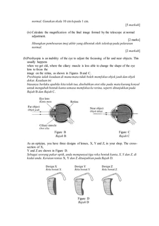 normal. Gunakan skala 10 cm kepada 1 cm.
[5 markah]
(iv) Calculate the magnification of the final image formed by the telescope at normal
adjustment.
[2 marks]
Hitungkan pembesaran imej akhir yang dibentuk oleh teleskop pada pelarasan
normal.
[2 markah]
(b)Presbyopia is an inability of the eye to adjust the focussing of far and near objects. This
usually happens
when we get old, where the ciliary muscle is less able to change the shape of the eye
lens to focus the
image on the retina, as shown in Figures B and C.
Presbiopia ialah keadaan di mana mata tidak boleh memfokus objek jauh dan objek
dekat. Keadaan ini
biasanya berlaku apabila kita telah tua, disebabkan otot silia pada mata kurang kenyal
untuk mengubah bentuk kanta semasa memfokus ke retina, seperti ditunjukkan pada
Rajah B dan Rajah C.
Figure B Figure C
Rajah B Rajah C
As an optician, you have three designs of lenses, X, Y and Z, in your shop. The cross-
section of X,
Y and Z are shown in Figure D.
Sebagai seorang pakar optik, anda mempunyai tiga reka bentuk kanta, X, Y dan Z, di
kedai anda. Keratan rentas X, Y dan Z ditunjukkan pada Rajah D.
Figure D
Rajah D
 