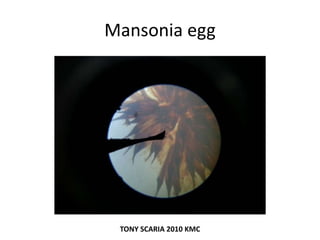 Mansonia egg
TONY SCARIA 2010 KMC
 