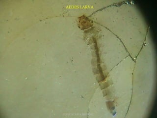 AEDES LARVA
TONY SCARIA 2010 KMC
 