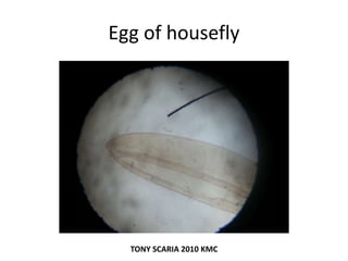 Egg of housefly
TONY SCARIA 2010 KMC
 