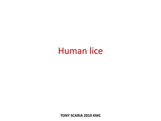 Human lice
TONY SCARIA 2010 KMC
 