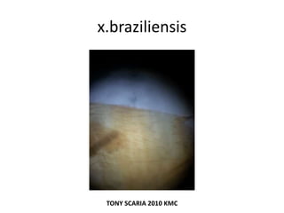 x.braziliensis
TONY SCARIA 2010 KMC
 