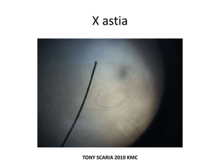 X astia
TONY SCARIA 2010 KMC
 