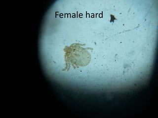 Female hard
TONY SCARIA 2010 KMC
 