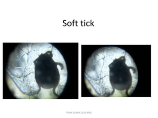 Soft tick
TONY SCARIA 2010 KMC
 