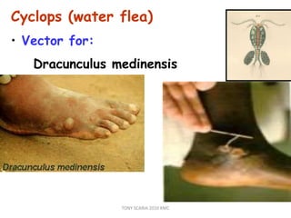 Cyclops (water flea)
• Vector for:
Dracunculus medinensis
TONY SCARIA 2010 KMC
 