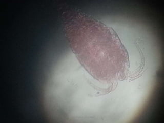 TONY SCARIA 2010 KMC
 