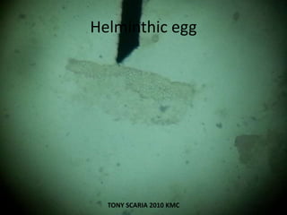 Helminthic egg
TONY SCARIA 2010 KMC
 