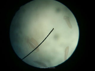 TONY SCARIA 2010 KMC
 