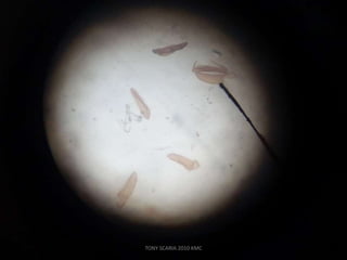 TONY SCARIA 2010 KMC
 