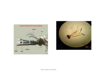 TONY SCARIA 2010 KMC
 