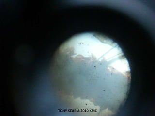 TONY SCARIA 2010 KMC
 