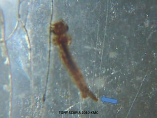 TONY SCARIA 2010 KMC
 