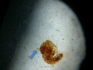 TONY SCARIA 2010 KMC
 