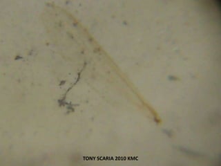 TONY SCARIA 2010 KMC
 