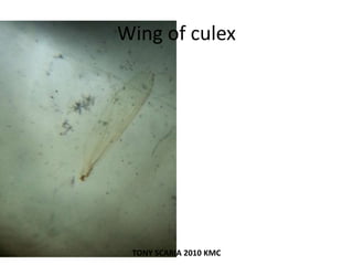 Wing of culex
TONY SCARIA 2010 KMC
 