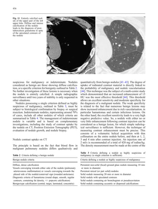 456



Fig. 11 Entirely calcified nod-
ule of the upper part of the left
upper lobe. Diffuse and intense
calcification of the nodule
leads to the diagnosis of post-
tuberculosis granuloma in spite
of the spiculated contours of
the nodule




suspicious for malignancy or indeterminate. Nodules                  quantitatively from benign nodules [41–43]. The degree of
considered as benign are those showing diffuse calcifica-            uptake of iodinated contrast material is directly linked to
tion, or a specific criterion for benignity outlined in Table 2.     the probability of malignancy and nodule vascularisation
No further investigation of these lesions is necessary when          [44]. This technique was the subject of a multi-centre study
the nodule is entirely calcified. A simple radiographic              which demonstrated that an increased enhancement of 15
surveillance until two years of stability is only requested in       HU was the most effective threshold [44]. This threshold
other situations.                                                    allows an excellent sensitivity and moderate specificity for
   Nodules possessing a single criterion defined as highly           the diagnosis of a malignant nodule. The weak specificity
suspicious of malignancy, outlined in Table 3, must be               is related to the fact that numerous benign lesions may
subject to histological confirmation by biopsy or surgical           show increased enhancement due to rich vascularisation, in
resection. Indeterminate nodules, representing around 70%            particular hamartomas and certain infectious lesions. On
of cases, include all other nodules of which criteria are            the other hand, the excellent sensitivity leads to a very high
summarised in Table 4. The management of indeterminate               negative predictive value. So, a nodule with either no or
nodule is variable and is based on complementary                     very little enhancement following contrast injection can be
investigations, including the study of contrast uptake by            considered as a benign lesion, for which simple radiolog-
the nodule on CT, Positron Emission Tomography (PET),                ical surveillance is sufficient. However, the technique of
evaluation of nodule growth, and nodule biopsy.                      measuring contrast enhancement must be precise. This
                                                                     consists of a volumetric helical acquisition with thin
                                                                     collimation on the entire nodule before, and then at 1, 2,
Nodule contrast uptake on CT                                         3 and 4 min after contrast injection. An injection rate of
                                                                     2 ml/s is recommended of a total of 420 mg of iodine/kg.
The principle is based on the fact that blood flow in                The density measurement must be made at the centre of the
malignant pulmonary nodules differs qualitatively and
                                                                     Table 3 Criteria defining a nodule as highly suspicious of
Table 2 Criteria defining a benign nodule                            malignancy (a single criterion is sufficient)
Benign nodule criteria                                               Criteria defining a nodule as highly suspicious of malignancy

Diffuse, dense calcification                                         Persistent non-solid (focal) ground glass nodule measuring 10 mm
Vessels converging towards either side of the nodule (pulmonary       or more in diameter
 arteriovenous malformation) or vessels converging towards the       Persistent mixed (or part solid) nodules
 pleural side of the nodule/comet-tail sign (rounded atelectasis)    Solid nodule measuring 20 mm or more in diameter
Diagnostic criteria of hamartoma (round shape, smooth, regular       Solid nodule with spiculated contours
 contours, containing fat density, +/– popcorn calcification)        Solid nodule containing air bronchogram or pseudocavitation
Benign-type calcification (central, target, laminated, concentric)   Solid nodule containing eccentric or dispersed calcifications
 