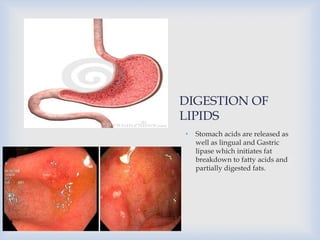 DIGESTION OF
LIPIDS
• Stomach acids are released as
well as lingual and Gastric
lipase which initiates fat
breakdown to fatty acids and
partially digested fats.
 