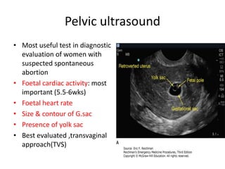 Pelvic ultrasound
• Most useful test in diagnostic
evaluation of women with
suspected spontaneous
abortion
• Foetal cardiac activity: most
important (5.5-6wks)
• Foetal heart rate
• Size & contour of G.sac
• Presence of yolk sac
• Best evaluated ,transvaginal
approach(TVS)
 