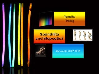 Our Speakers Today:
Yumeiho
Trainig
Constanţa 20 07 2014
Spondilita
anchilopoetică
 