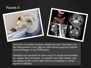 Radiațiile X (numite mai târziu radiații sau raze “Roentgen”) au
fost descoperite în anul 1895 de către fizicianul german Wilhelm
Conrad Röntgen în mod întâmplător.
Radiațiile sunt absorbite de către corpuri în funcție de densitatea
lor: oasele, fiind mai dense, vor absorbi mai multă radiație, deci
vor apărea pe film ca fiind albe (filmul se înnegrește în părțile
expuse la radiație)
Razele X
 
