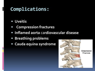 Complications:
 Uveitis
 Compression fractures
 Inflamed aorta cardiovascular disease
 Breathing problems
 Cauda equina syndrome
 