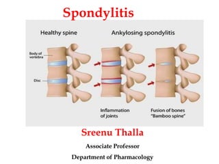 Spondylitis
Sreenu Thalla
Associate Professor
Department of Pharmacology
 