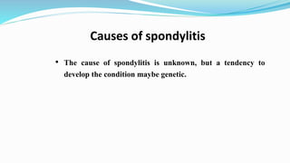 • The cause of spondylitis is unknown, but a tendency to
develop the condition maybe genetic.
Causes of spondylitis
 