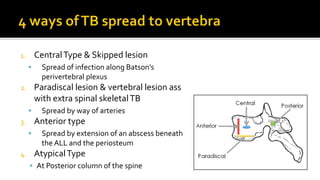 1. CentralType & Skipped lesion
 Spread of infection along Batson’s
perivertebral plexus
2. Paradiscal lesion & vertebral lesion ass
with extra spinal skeletalTB
 Spread by way of arteries
3. Anterior type
 Spread by extension of an abscess beneath
the ALL and the periosteum
4. AtypicalType
 At Posterior column of the spine
 
