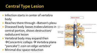  Infection starts in center of vertebra
body
 Reaches there through –Batson’s plexus
 Diseased body looses trabeculations in
central portion, shows destruction/
radiolucent lesion
 Vertebral body may expand then
Concentric collaps Vertebra plana /
“pancake”/ :coin on edge vertebra”
 Minimal disc space reduction
 