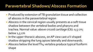  Produced by extension ofTB granulation tissue and collection
of abscess in the paravertebral region
 Abscess in the cervical region usually presents as a soft tissue
shadow between the vertebral bodies and pharynx and
trachea. Normal value: above cricoid cartilage (C6): 0,5 cm;
below 1,5 cm
 In the upper thoracic abscess, on AP view cast aV-shaped
shadow stripping the lung apices laterally and downwards.
 Abscess below the levelTh4 vertebra produce typical fusiform
shape
 