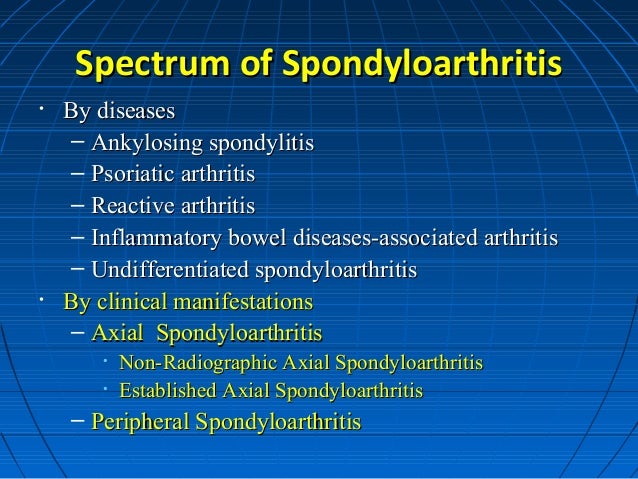 Spondyloarthritis for medical students