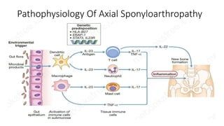 Pathophysiology Of Axial Sponyloarthropathy
 