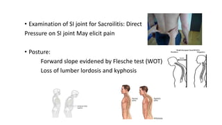 • Examination of SI joint for Sacroilitis: Direct
Pressure on SI joint May elicit pain
• Posture:
Forward slope evidened by Flesche test (WOT)
Loss of lumber lordosis and kyphosis
 