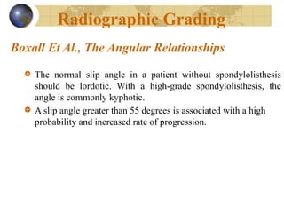 Comprehensive Overview of Spondylolisthesis: Anatomy, Classification ...