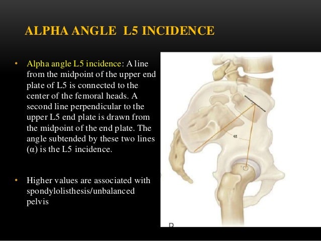 antero listhesis antero listhesis