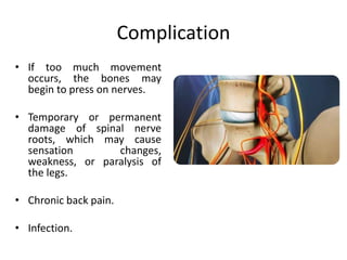 Complication
• If too much movement
occurs, the bones may
begin to press on nerves.
• Temporary or permanent
damage of spinal nerve
roots, which may cause
sensation changes,
weakness, or paralysis of
the legs.
• Chronic back pain.
• Infection.
 