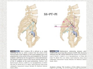SS+PT=PI
 
