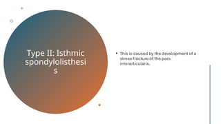 Type II: Isthmic
spondylolisthesi
s
• This is caused by the development of a
stress fracture of the pars
interarticularis.
 