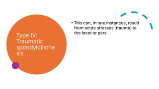 Type IV:
Traumatic
spondylolisthe
sis
• This can, in rare instances, result
from acute stresses (trauma) to
the facet or pars.
 