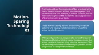 Motion-
Sparing
Technologi
es
The Food and Drug Administration (FDA) is reviewing the
use of devices inserted without invasive surgery to limit
vertebral motion. For example, a special titanium implant
has been designed to fit between the spinous processes
of the vertebrae in lower back.
These motion-sparing devices are currently used with
patients who have spinal stenosis (narrowing of the
spinal canal or foramen).
With spondylolisthesis, the goal is to reduce the load on
the disc and facets while increasing the space inside the
spinal canal and foramen, thus relieving symptoms. The
vertebral segment is stabilized enough to prevent further
progression of the spondylolisthesis.
 