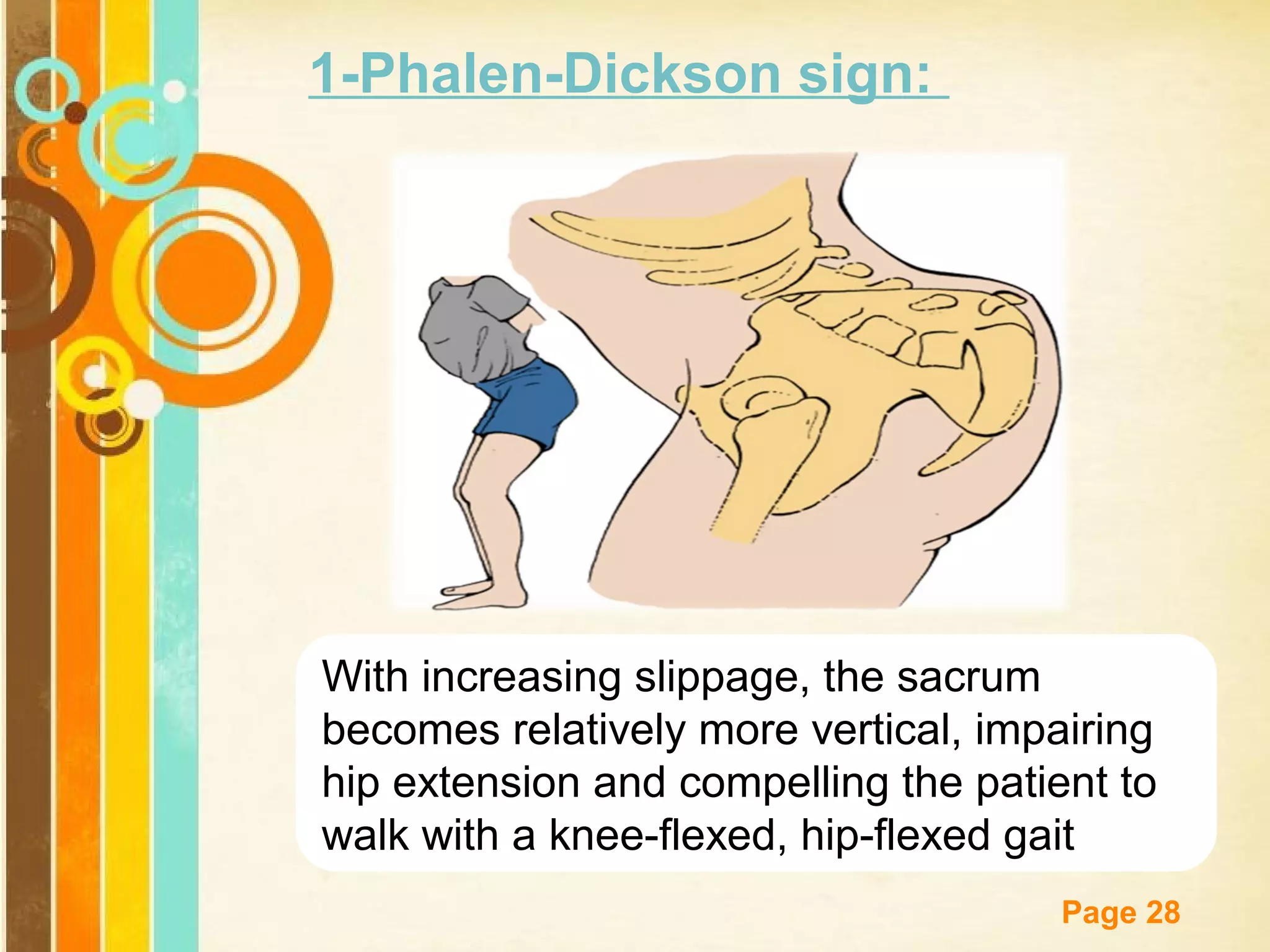 1-Phalen-Dickson sign:

With increasing slippage, the sacrum
becomes relatively more vertical, impairing
hip extension and compelling the patient to
walk with a knee-flexed, hip-flexed gait
Free Powerpoint Templates

Page 28

 