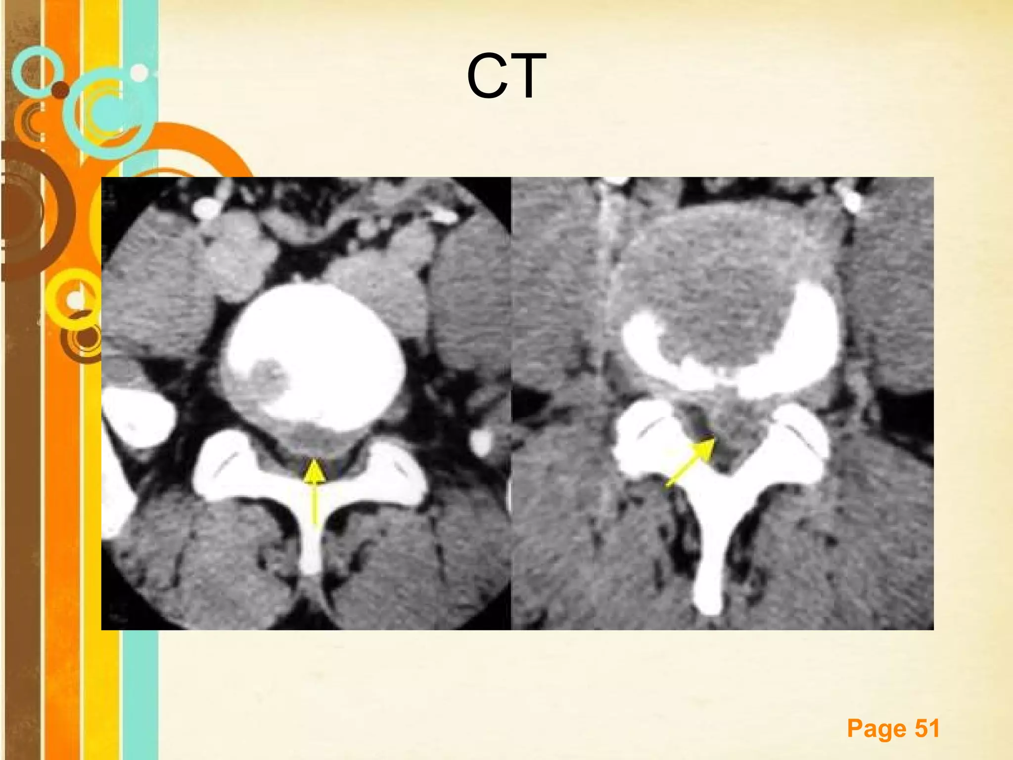 CT

Free Powerpoint Templates

Page 51

 