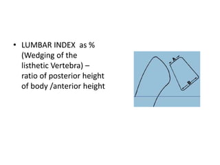 • LUMBAR INDEX as %
(Wedging of the
listhetic Vertebra) –
ratio of posterior height
of body /anterior height
 