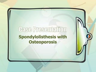 Spondylolisthesis with
Osteoporosis
 