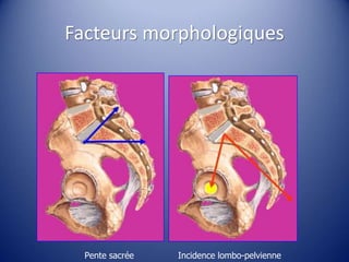 Facteurs morphologiques
Pente sacrée Incidence lombo-pelvienne
 