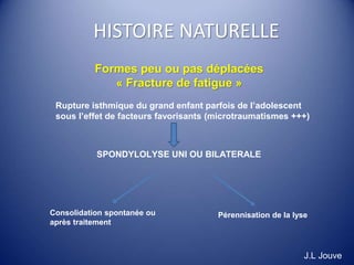 HISTOIRE NATURELLE
Rupture isthmique du grand enfant parfois de l’adolescent
sous l’effet de facteurs favorisants (microtraumatismes +++)
SPONDYLOLYSE UNI OU BILATERALE
Consolidation spontanée ou
après traitement
Pérennisation de la lyse
Formes peu ou pas déplacées
« Fracture de fatigue »
J.L Jouve
 