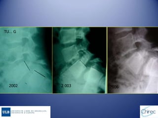 TU… G
2002 2 003 2006
 