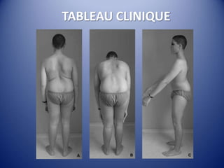 TABLEAU CLINIQUE
 